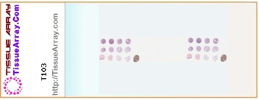 TissueArray.Com Tissue Array T103