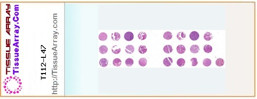 TissueArray.Com Tissue Array T112-L47