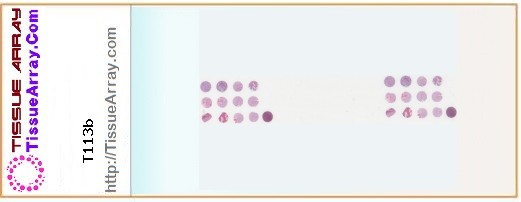 TissueArray.Com Tissue Array T113b