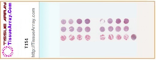 TissueArray.Com Tissue Array T151
