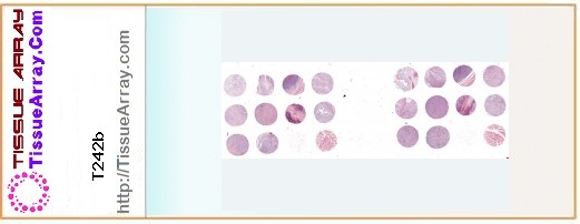 TissueArray.Com Tissue Array T242b