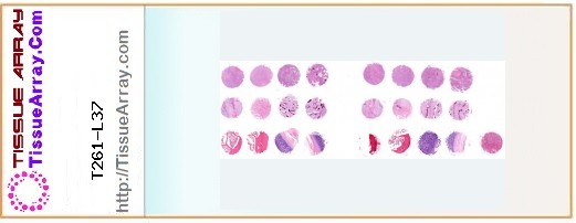 TissueArray.Com Tissue Array T261-L37