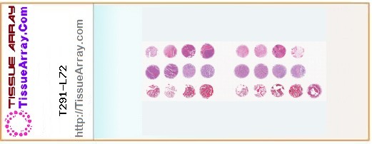 TissueArray.Com Tissue Array T291-L72