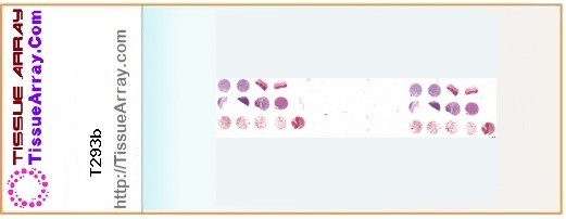 TissueArray.Com Tissue Array T293b