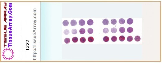 TissueArray.Com Tissue Array T322