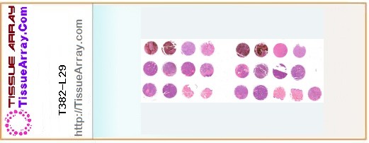 TissueArray.Com Tissue Array T382-L29