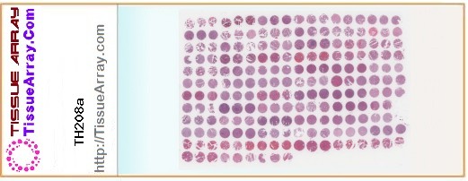 TissueArray.Com Tissue Array TH208a