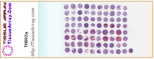 TissueArray.Com Tissue Array TH802a