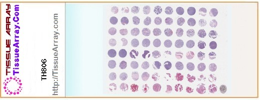 TissueArray.Com Tissue Array TH806