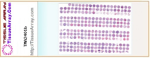 TissueArray.Com Tissue Array TMA2401b