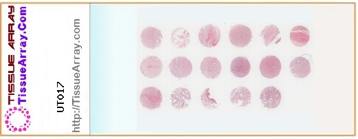 TissueArray.Com Tissue Array UT017