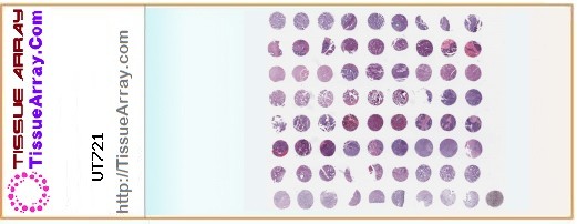 TissueArray.Com Tissue Array UT721