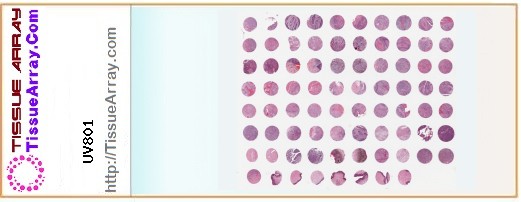 TissueArray.Com Tissue Array UV801